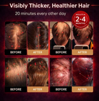 Red Light Therapy Hair Growth